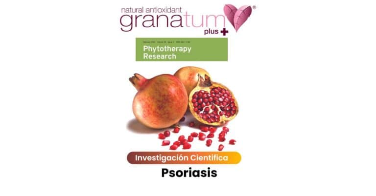 psoriasis